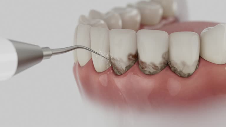 Trusted Dental Crowns And Bridges service in Archer Lodge, NC - Dentist Open Now